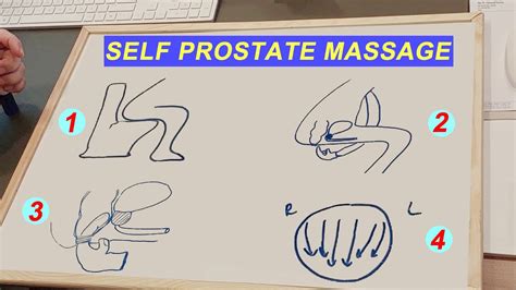 massage your own prostate|Prostate milking (massage): Definition and how to do it